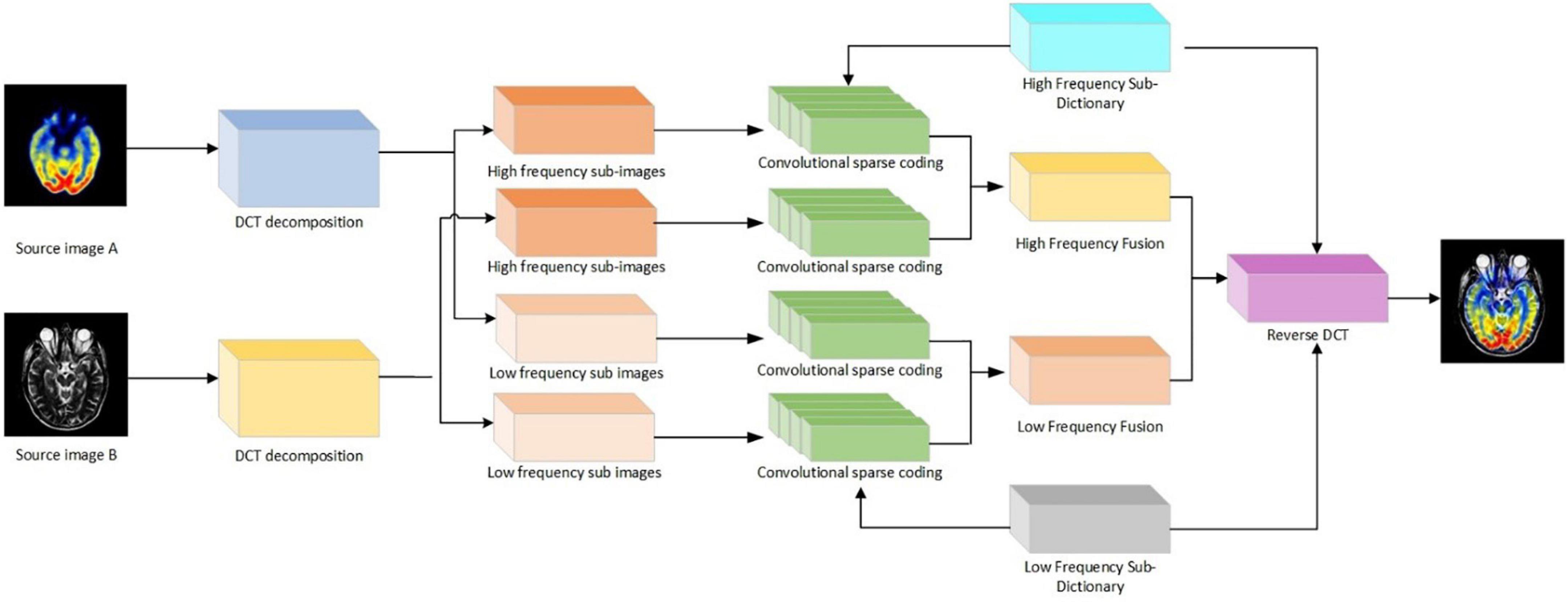 A multimodal fusion method for Alzheimer’s disease based on DCT convolutional sparse representation